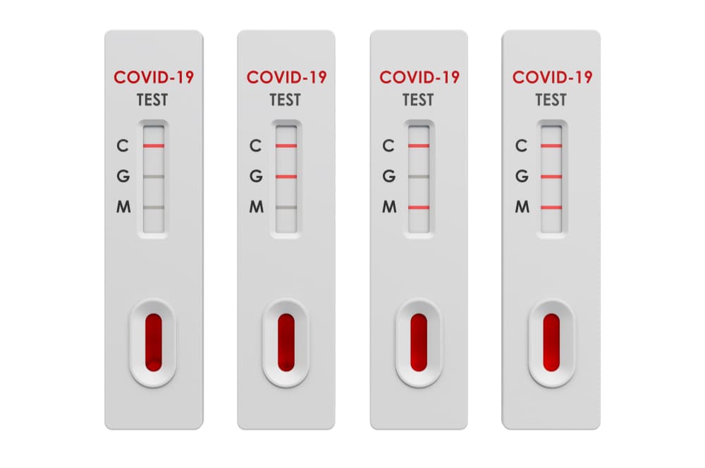 SARS-CoV-2 (Covid-19): Diagnosis by IgG/IgM Rapid Test Generon