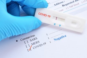 SARS-CoV-2 (Covid-19): Diagnosis by IgG/IgM  Rapid Test
