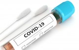SARS-CoV-2 - Products for Diagnosis - Sampling and Transport Media