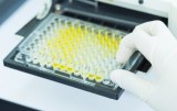 SARS-CoV-2 - Products for diagnosis - ELISA kits
